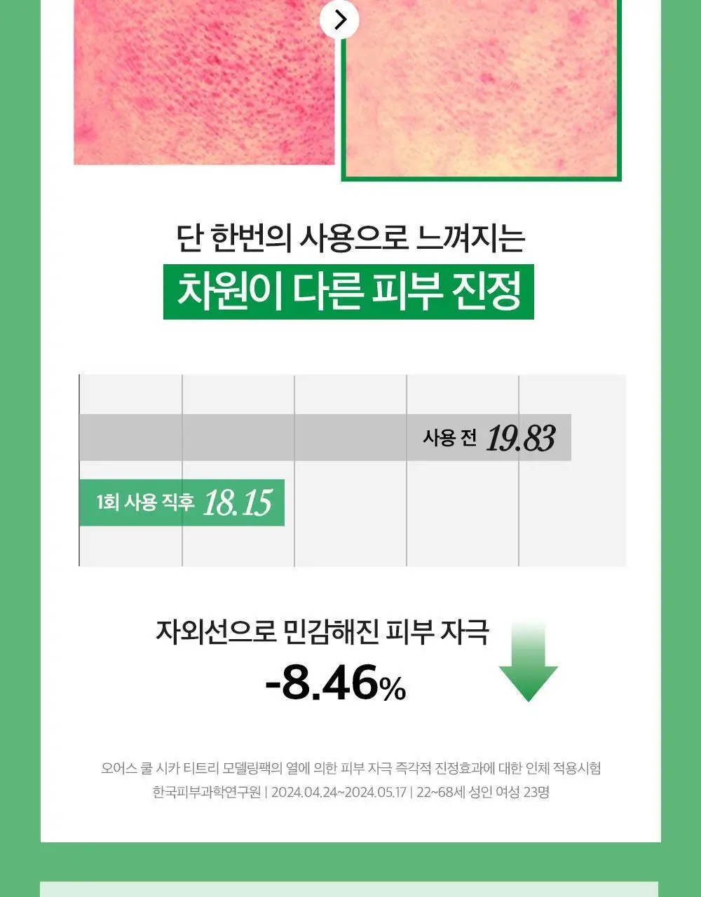 [급속쿨링진정 / 모공쪼임] 오어스 쿨 시카 티트리 모델링 팩 풀패키지 상세페이지 20